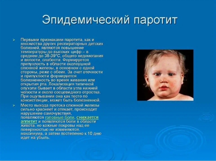 Паротит! Что нужно знать? Паротит! Что нужно знать?.